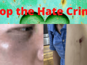 Stop the Hate Crime